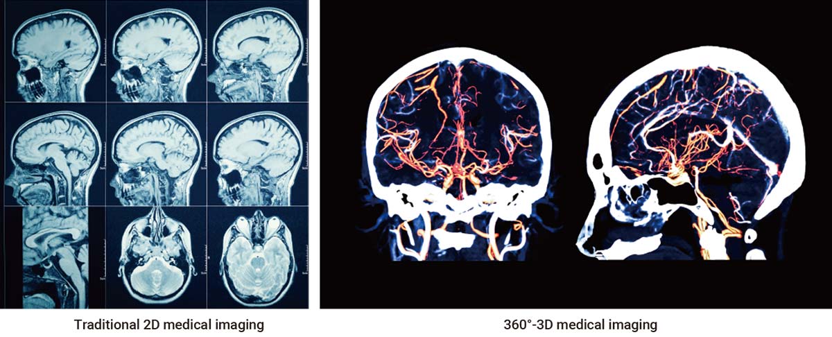 360° 3D Medical Imaging Powered by Neousys Edge AI Platform