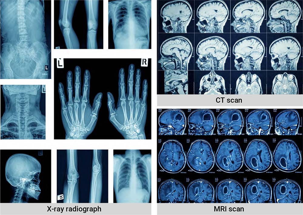 Medical Imaging Mobile Xray Neousys Technology